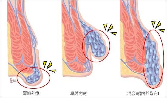 肛门人口_人口普查(2)