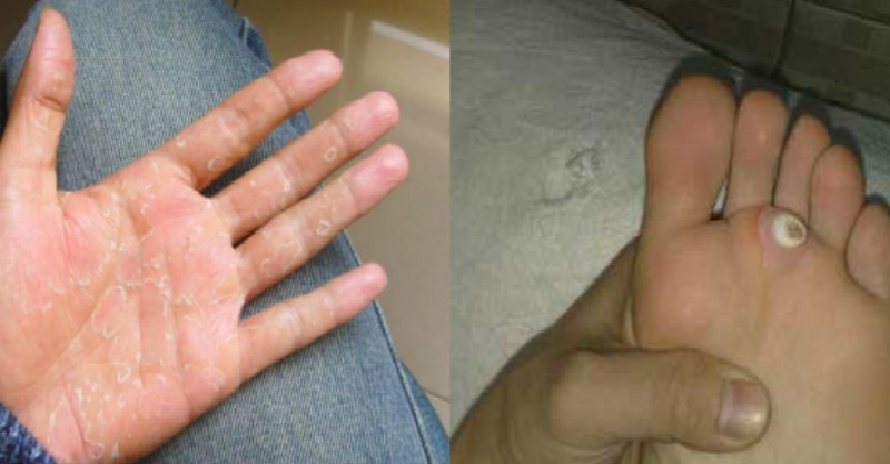 32个小偏方一次性帮你解决手脱皮,脚跟痛,手脚抽筋,脚