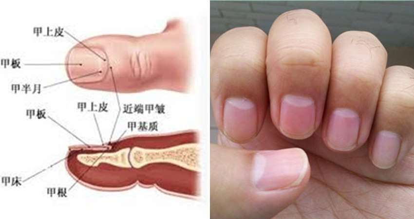 指甲上的「月牙」直接反映你的身体状况,中医专家教你