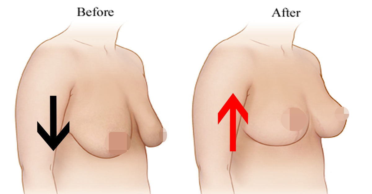 胸部越老越垂 不分年紀 逆齡美胸8妙招 阻止地心引力拉垮 木瓜奶 Love分享