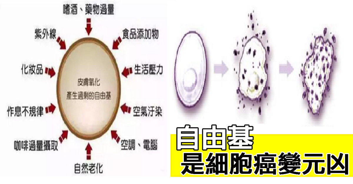 专家:吃「两种抗氧化物」最能有效清除观看数:253 人 自由基是无处不