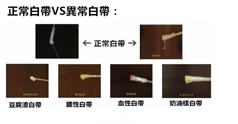 视频「白带偏黄」很困扰,4招教你让美女恢复正常!白带弹钢琴女生街头图片