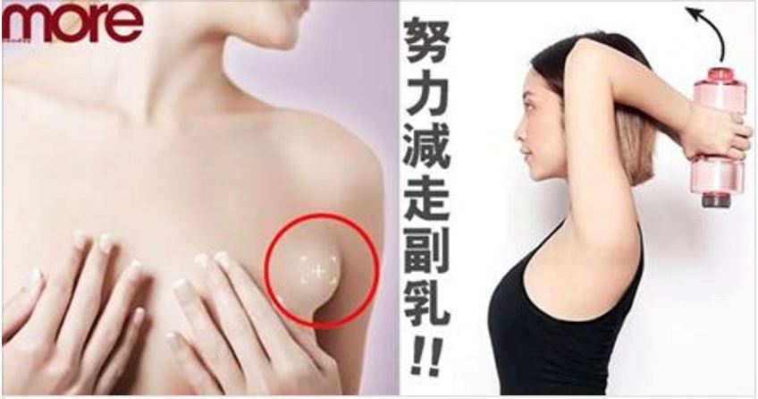 消除副乳内衣_副乳怎么可以消除(2)