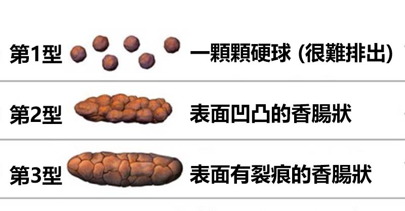 7种大便形状「仔细观赏」能救你一命,「大便太臭」少吃这些能改善!