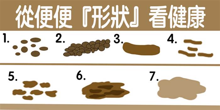 【便便形状】大解密!过硬,过稀恐「肠躁症」,「肠癌」