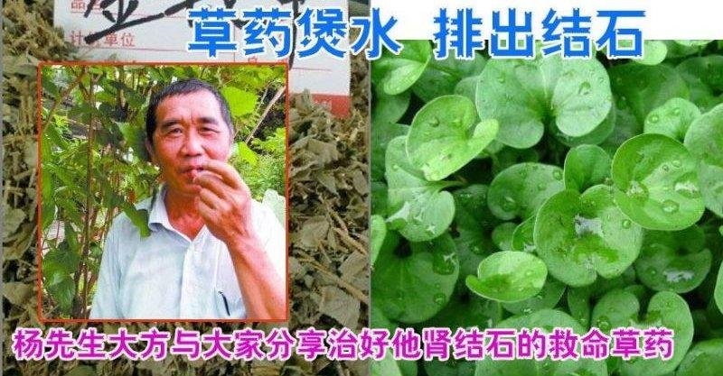 患上肾结石,不需开刀,用金钱草煲水,就能排肾结石