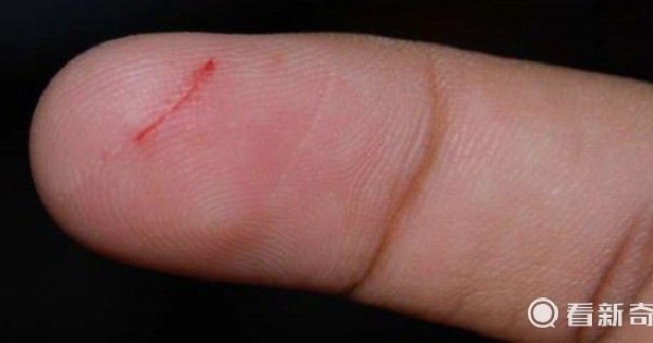 为什麼手指被薄薄的纸张割伤,明明伤口很细小却令人感到特别的痛?
