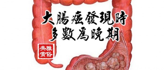 大腸癌發現時多數為晚期 早期檢測和預防方法你需要知道!