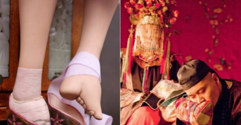 她是最后的「三寸金莲」!回忆新婚丈夫首次看到她拆下裹脚布时.