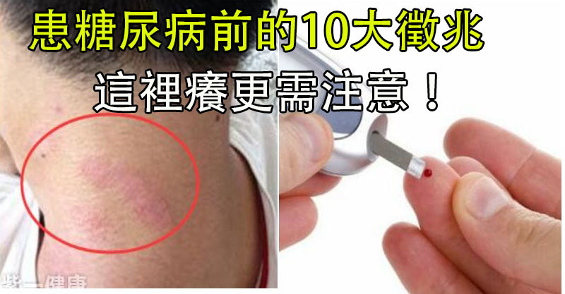 男女患糖尿病前的10大徵兆,对号入座快自查!这里痒更需注意!