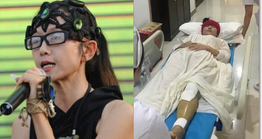 59岁杨丽萍训练摔骨折,20多年没自己洗过澡,在医院提条件被拒绝!