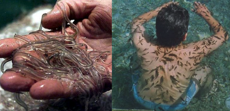 一名男子想利用鳗鱼吃掉自己脚上坏死的皮肤组织,不过最终这些小鳗鱼