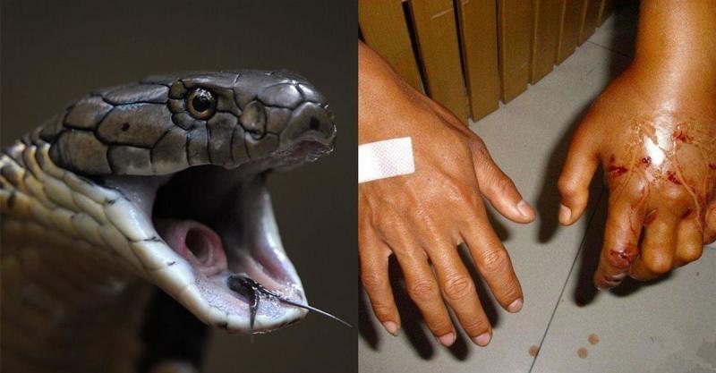 一分钟都让人致命的毒蛇,被咬后竟有一种方法可以破解救回性命!