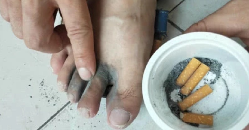 把烟灰抹在脚上作用真不小,知道的还不多,学会了能帮你大忙!